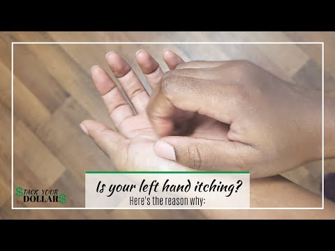 Left Hand Itching? It May Mean Money